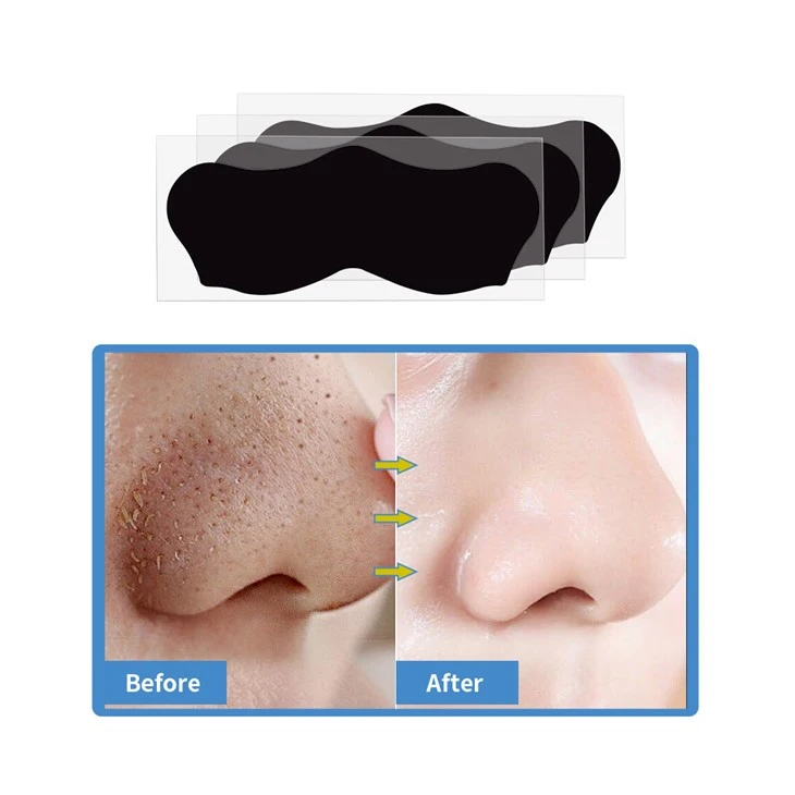 pore strips (1)